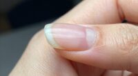 nail lifting causes and prep