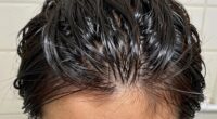 contradictory scalp condition diagnosis