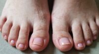different care for toenails