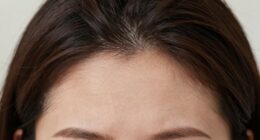 hairline health signals