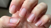 nail damage warning signs