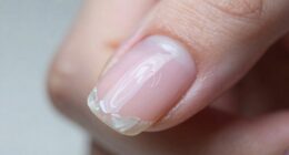 nails peel despite caution