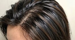 oily scalp dry lengths