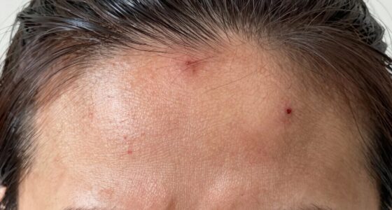 scalp tension and discomfort