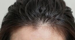 unexpected scalp camera advantages
